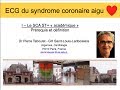 8a. ECG du syndrome coronaire aigu. Prérequis et définitions. P. Taboulet