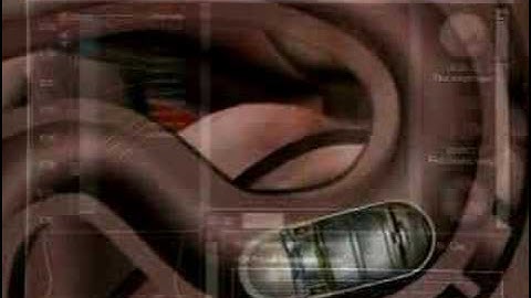 Live Webcast: Pediatric Capsule Endoscopy