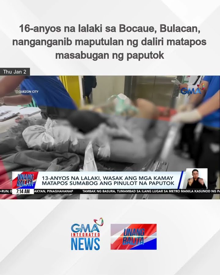 16-anyos na lalaki sa Bocaue, Bulacan, nanganganib maputulan ng daliri matapos... | Unang Balita