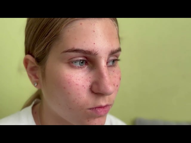 YouTube Preview