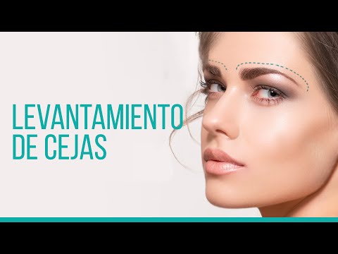 Video: ¿Qué es un levantamiento de cejas?