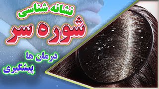 شوره سر | همه چیز درباره شوره سر در کمترین زمان ممکن!!! | Medical Facts