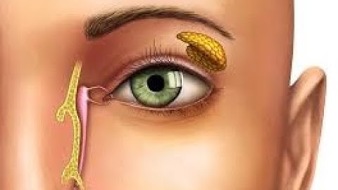 Dacryocystorhinostomy CPT code - simplify medical coding