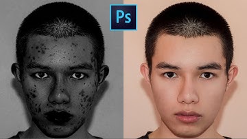 How to Enable “X-Ray” to Remove Blemishes in Photoshop | 1-minute Tutorial