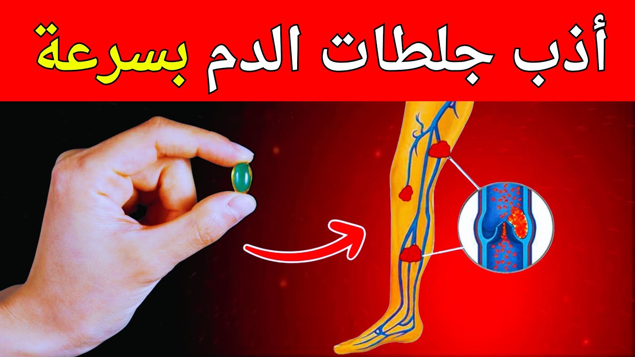 أفضل الفيتامينات التي تذيب جلطات الدم في الساقين وتقوي الدورة الدموية