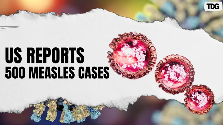US Measles Outbreak Surges: Nearly 500 Cases Reported, Texas Worst Hit