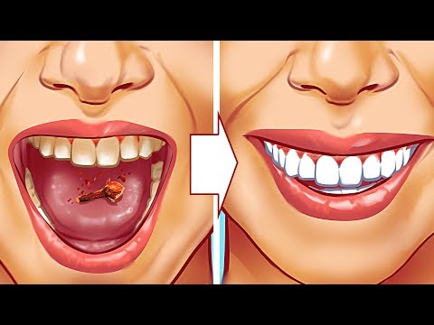 Vídeo: És necessari eliminar una dent del seny i en quins casos