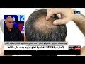 طرق علاج تساقط الشعر ... أسرع طريقة لمنع التساقط وتطويل الشعر