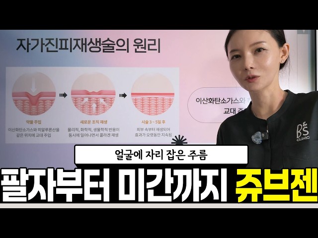 쥬브젠 자가진피재생술이란? 팔자주름·여드름흉터 적용 원리 알아보기