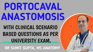 PORTOCAVAL ANASTOMOSIS