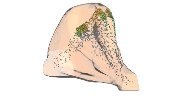 Nasal Drug Delivery - CFD Simulation