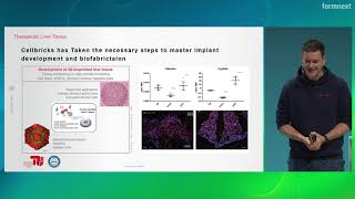 Formnext Expert Insight - The future of organ biofabrication: Multi-material light-based bioprinting