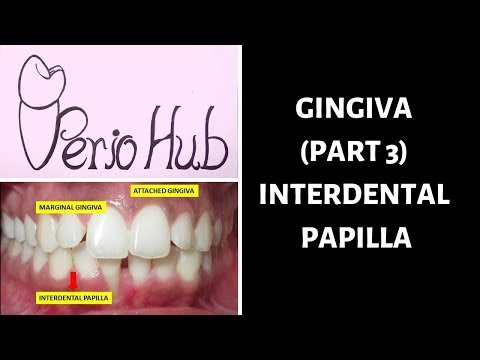 GINGIVA - INTERDENTAL PAPILLA