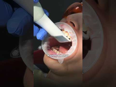 3D-сканер для чего он нужен? #shorts