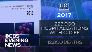 CDC report warns of 2 new potentially deadly superbugs