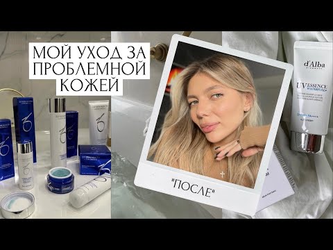 УХОД ЗА ПРОБЛЕМОЙ КОЖЕЙ ЛИЦА | КАК БОРОТЬСЯ С АКНЕ И ПОСТАКНЕ | Zo Skin Obagi, Babor,Dr.Jart, D’Alba