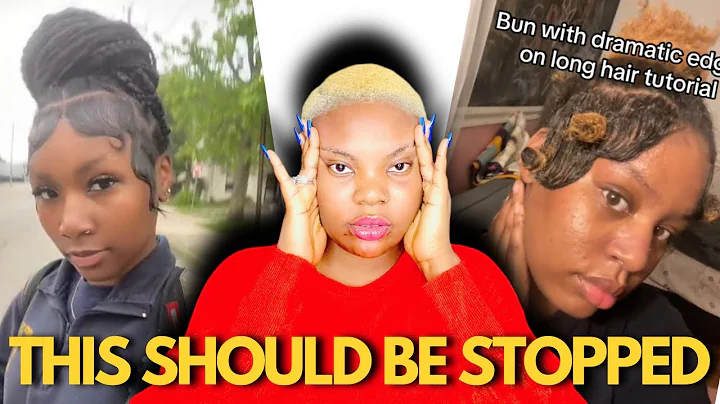 Are These Edges/Baby Hair Blindness Getting Out Of Control!?