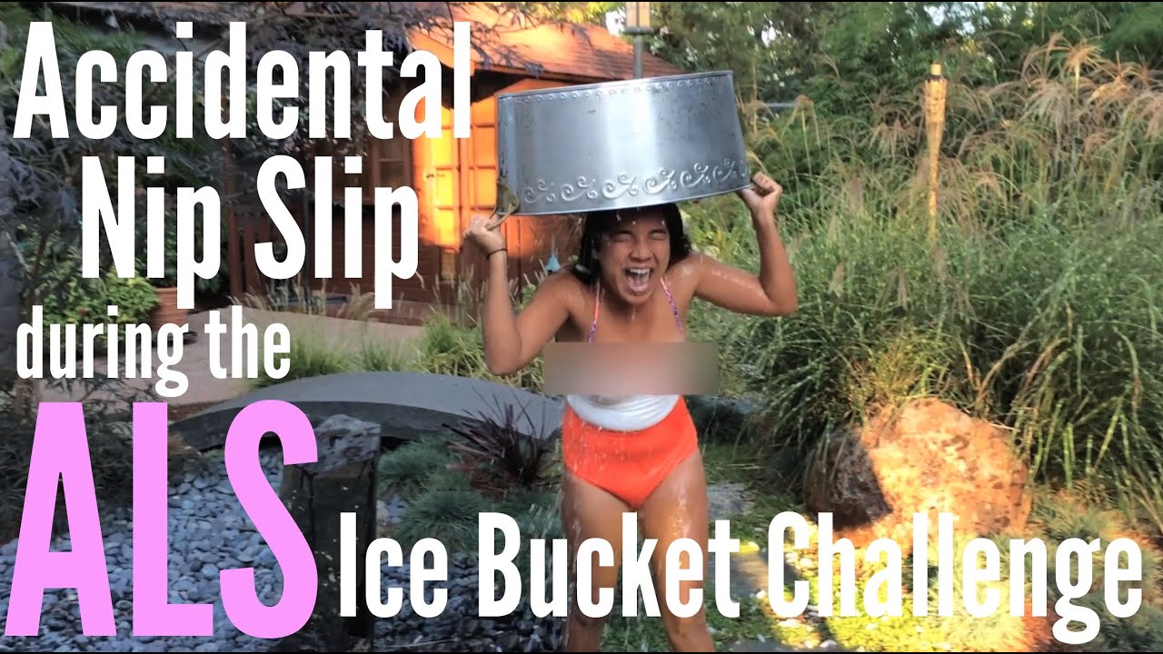 Accidental Nip Slip during ALS Ice Bucket Challenge 
