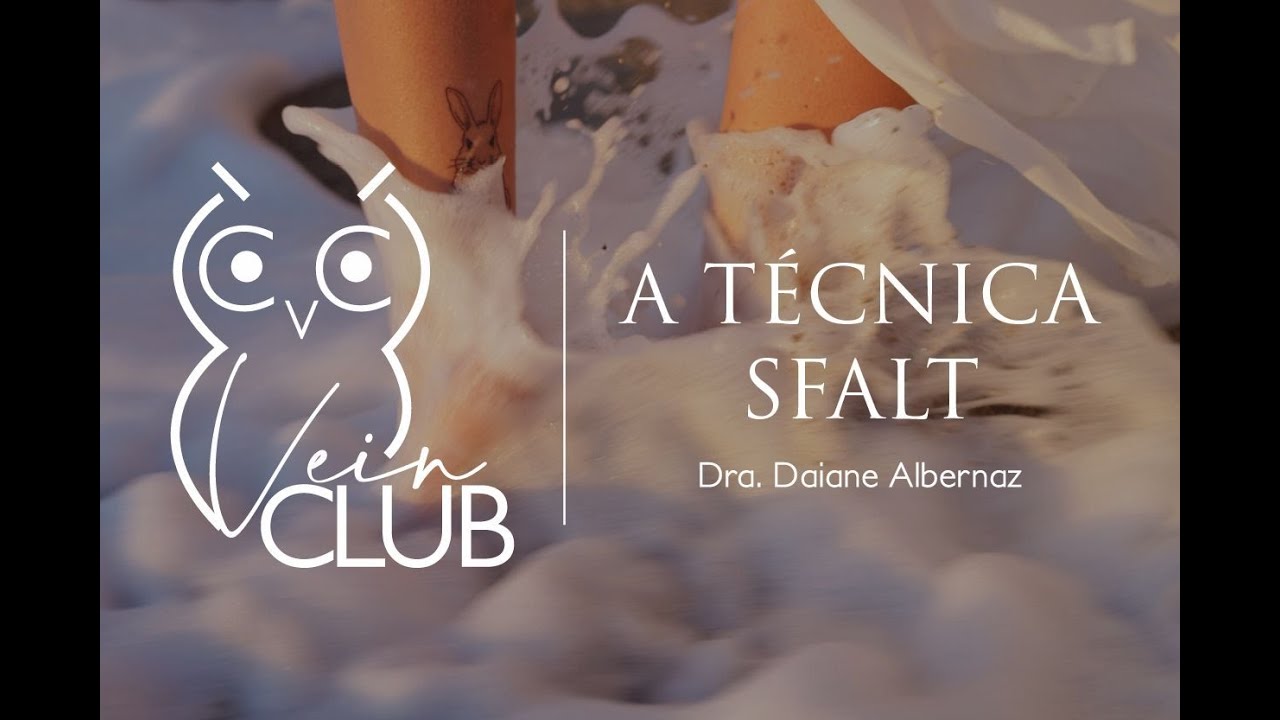 Vein Club : A técnica SFALT - Sclerofoam Assisted Laser Therapy : pela dra. Daiane Albernaz