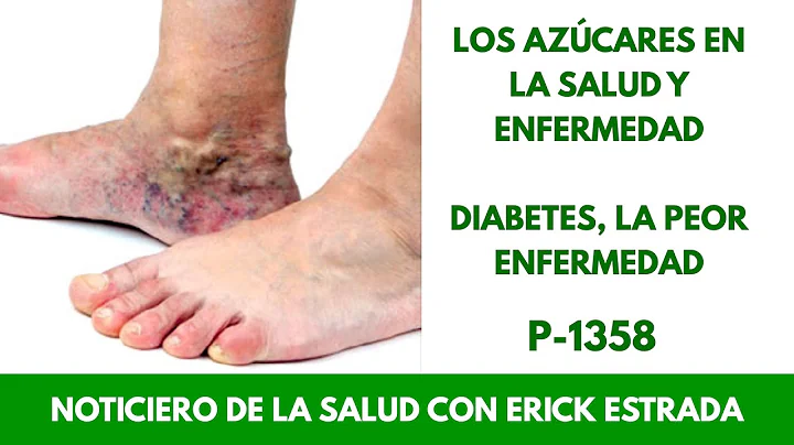 P 1358 Los azcares en la salud y en la enfermedad ...