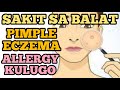 SAKIT sa BALAT: Pimple, Eczema, Allergy, Cellulite, Kulugo – by Doc Katty Go #30b