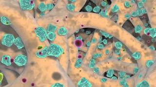 Lifenet Pad Demineralization