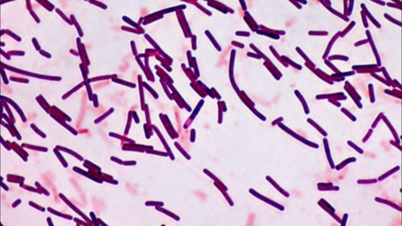 Escherichia coli под микроскопом по граму. Грамотрицательные бактерии кишечная палочка. Грамотрицательные бактерии палочки. Грамотрицательные бактерии палочки. Грамотрицательные бактерии палочки.