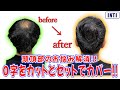 【薄毛】頭頂部のお悩みをカットとセットで解消！！