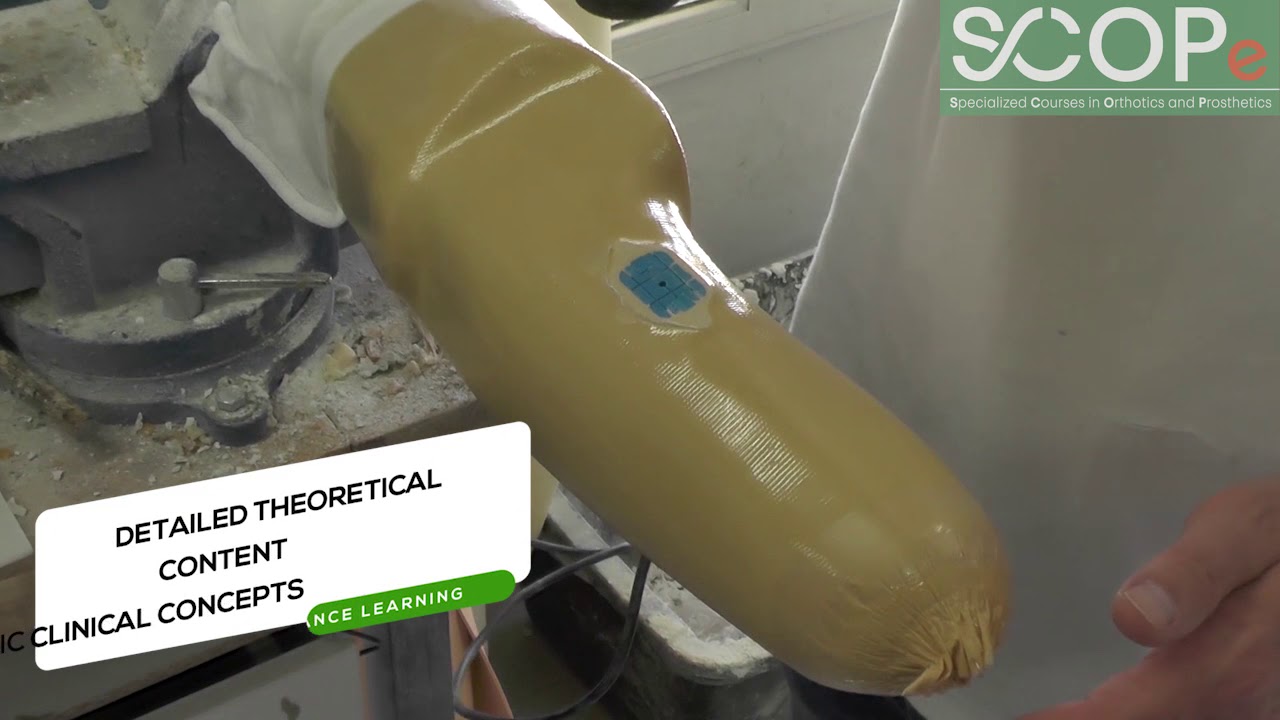 SCOPe Myoelectric Upper Extremity Prosthetics Trailer