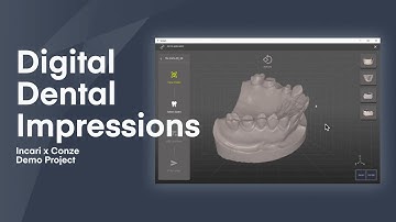 3D Digital Dental Impressions — Incari Demo Project
