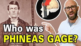 The Remarkable Tale of Phineas Gage