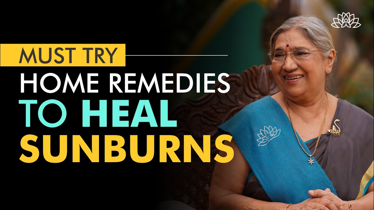 SunBurn Home Remedies How to Treat SunTan Naturally at Home? YouTube