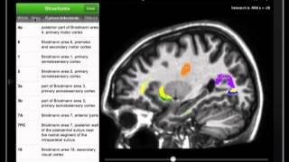 Summary of Elsevier's MRI Atlas of Human White Matter tool