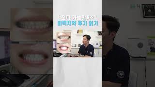 &quot;고작 한 달 썼는데..?&quot; 과대광고 미백치약 리뷰 읽기 #쇼츠 #shorts