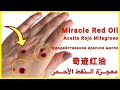 APPLY 2 DROPS OF THIS RED OIL, SEE WHAT HAPPENS? MIRACULOUS ANTI-AGING Red OIL