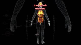 anaphylaxis treatment step by #music step