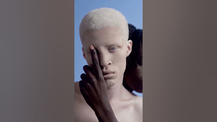 13 Giugno: Giornata Internazionale dell'ALBINISMO #albinism #albinismo #notghosts 🧑‍🦳🧝