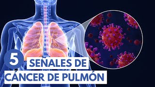 5 señales de cáncer de pulmón | Animación 3D