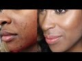 Cover Blemishes/Faux "Mustache" FAST w/ LESS Product!