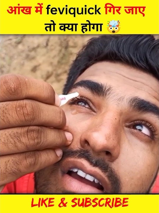 😱आंख के Feviquick गिर जाए तो क्या होगा 🤯 #youtubeshorts #ytshorts #trending #shorts #feviquick