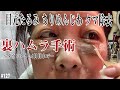 目元のたるみ ちりめんじわ クマとさよなら【裏ハムラ 】で若返り Ver.127♥
