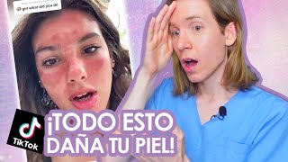 DERMATOLOGO reacciona A TIK TOK 9: Limon en la cara, quemaduras y locuras varias - Simon Scarano