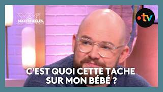 Cest Quoi Cette Tache Sur Mon Bébé ? - Les Maternelles Xxl