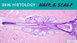 Hair follicle under microscope & scalp skin histology (dermatology dermpath pathology anatomy)