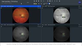 How to use Advanced Review tools of ZEISS FORUM 4.4.