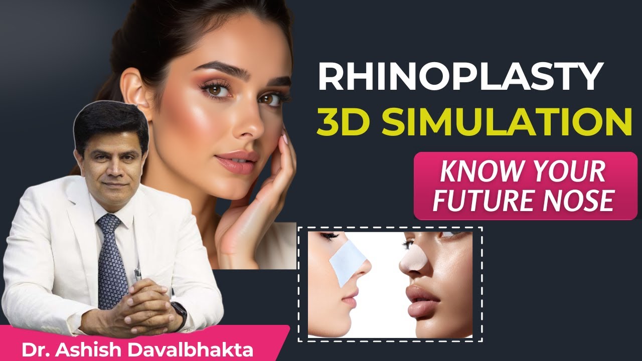 3D Rhinoplasty Simulation – See Your Nose Transformation Before Surgery!