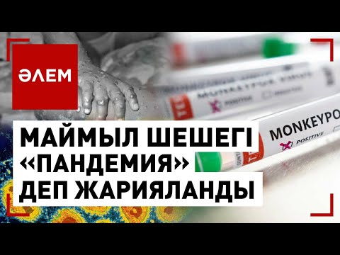 Маймыл шешегі «пандемия» деп жарияланды | Әлем