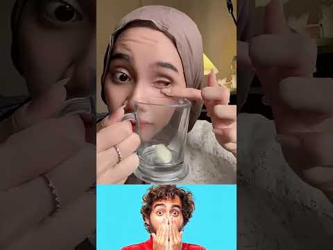 عين حمراء دويتو Fun ضحك كوميديا ترند شلتنا اعتني سعودية العراق سوريا لبنان الجزائر 