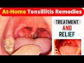 Tonsillitis: HOME Remedies and Cures for Fast TREATMENT | Treat tonsillitis naturally