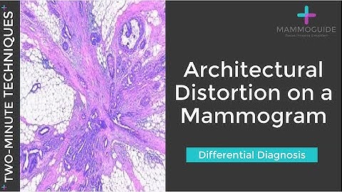 Two Minute Techniques - Architectural Distortion DDx